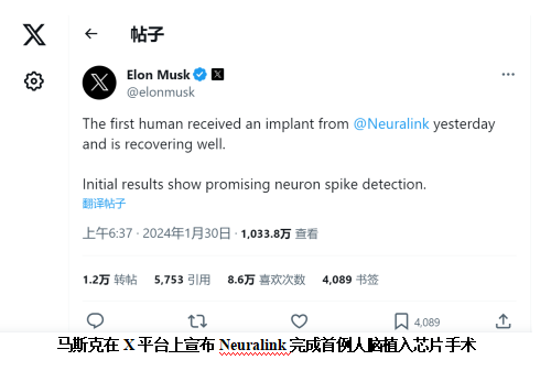 馬斯克宣布Neuralink完成首例人腦植入芯片手術